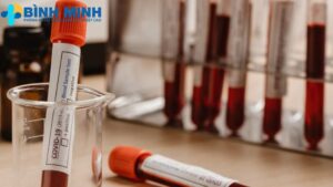 Dịch vụ xét nghiệm máu tại Đà Nẵng 7 Dịch vụ xét nghiệm máu tại Đà Nẵng