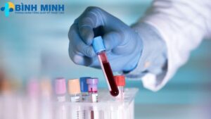 Xét nghiệm máu Đà Nẵng uy tín 6 Xét nghiệm máu Đà Nẵng uy tín