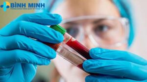 Phòng khám xét nghiệm máu Đà Nẵng 7 xét nghiệm máu Đà Nẵng