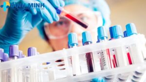 Các loại xét nghiệm máu Đà Nẵng