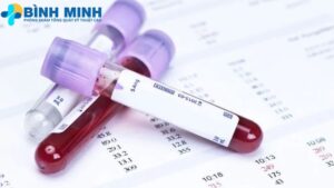 Chi phí xét nghiệm máu Đà Nẵng 8 Chi phí xét nghiệm máu Đà Nẵng