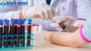 Phòng khám xét nghiệm máu Đà Nẵng 8 xét nghiệm máu Đà Nẵng