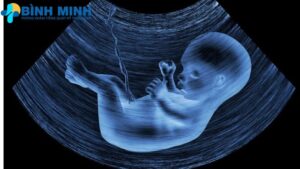 Dịch vụ siêu âm Đà Nẵng 8 dich vu sieu am tai da nang