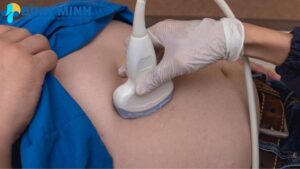 Siêu Âm Tổng Quát Đà Nẵng 8 sieu am tong quat da nang
