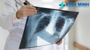 Thời gian trả kết quả X quang Đà Nẵng 6 thoi gian tra ket qua x quang tai da nang