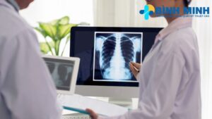 Thời gian trả kết quả X quang Đà Nẵng 7 thoi gian tra ket qua x quang tai da nang