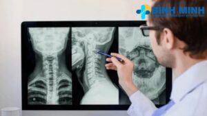 Thời gian trả kết quả X quang Đà Nẵng 5 thoi gian tra ket qua x quang tai da nang