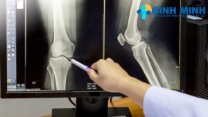 Chụp X quang có đau không Đà Nẵng 7 chup x quang co dau khong da nang