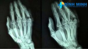 Địa chỉ chụp X quang uy tín tại Đà Nẵng 7 dia chi chup x quang u tin tai da nang